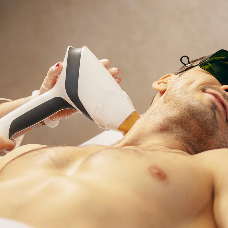 epilation-laser-expertise-techniques-outils-pornic