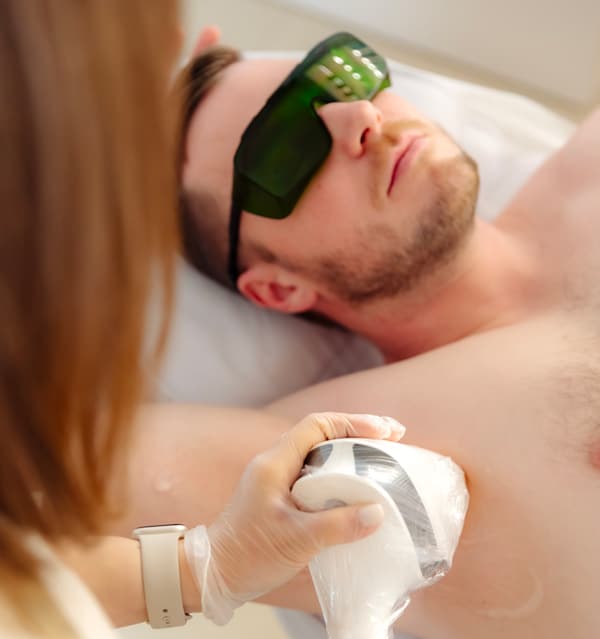 epilation-laser-homme-essence-du-soin